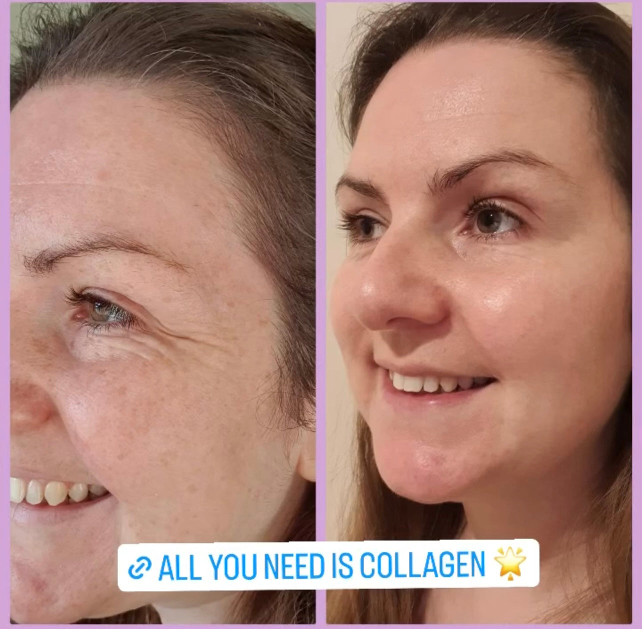 Forever Marine Collagen™