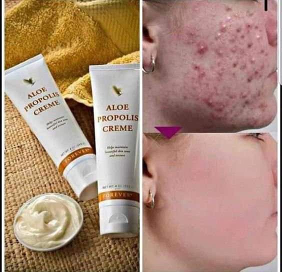 Aloe Propolis Creme